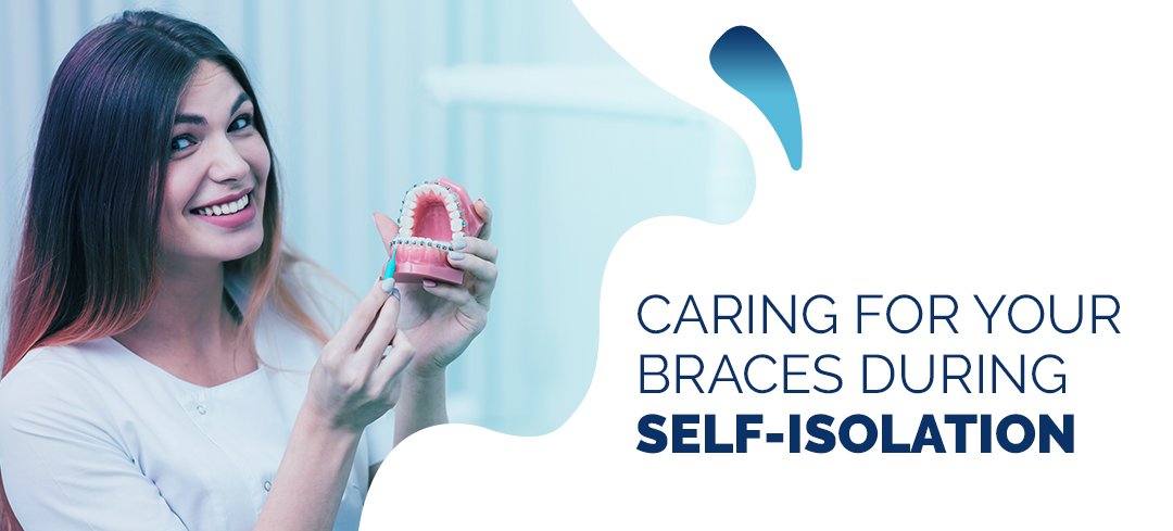 Caring for Your Braces During Self-Isolation