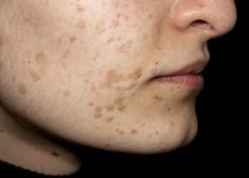 HPV: What is this infection?