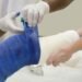 Avulsion Fractures: Treatment and Prevention