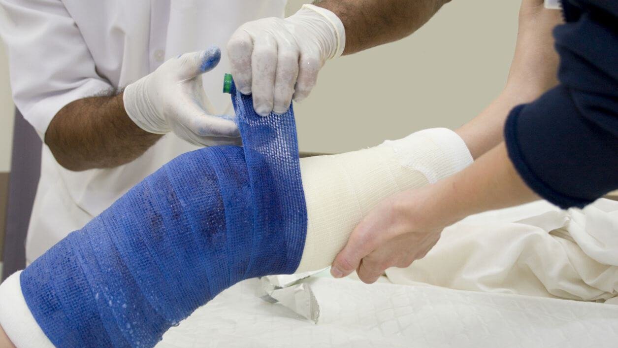 Avulsion Fractures: Treatment and Prevention