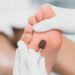 Why Do You Need to See A Foot Specialist? Here’s Help You May Need At Las Vegas