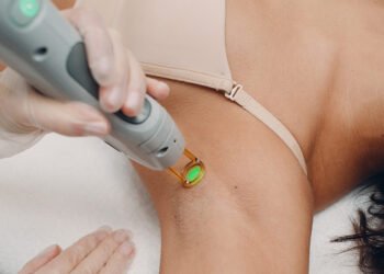 Top 6 Benefits of Laser Hair Removal