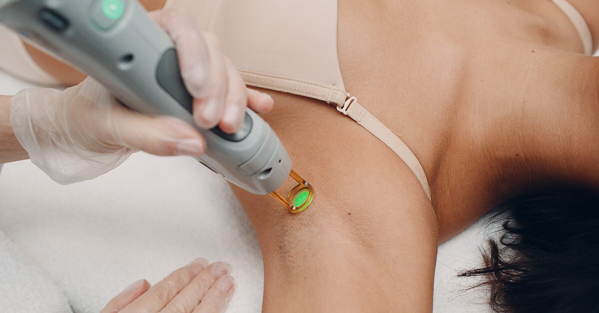 Top 6 Benefits of Laser Hair Removal