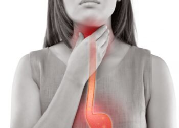 All You Need to Know About Acid Reflux