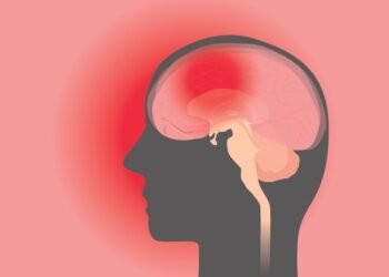 Concussion; The Facts