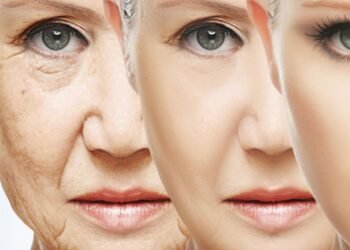 Signs of Aging