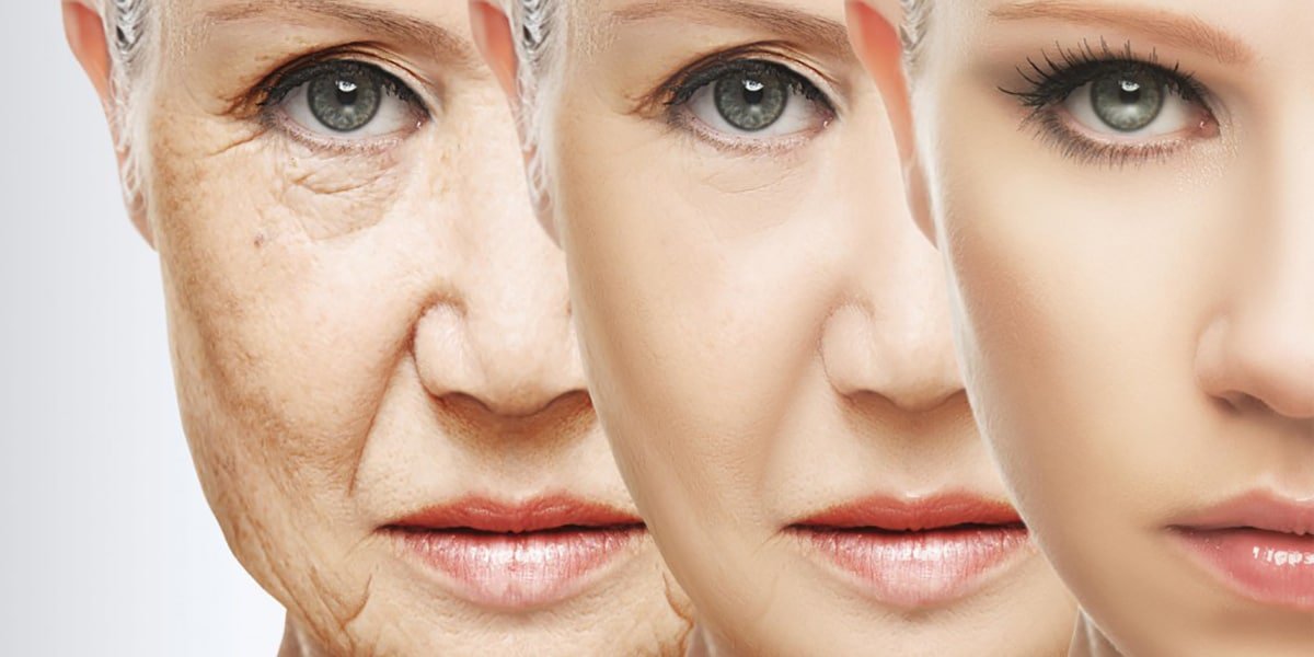 Signs of Aging