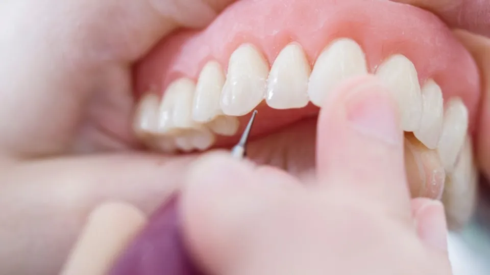Removable Dentures – Pros and Cons