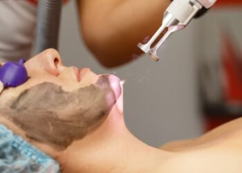 Carbon Peel Treatment