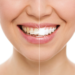 Invite Your Smile: Benefits of Composite Veneers